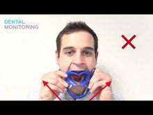 Load and play video in Gallery viewer, Dr. Aligner Monitoring Retractors - for use with or without Scan Box