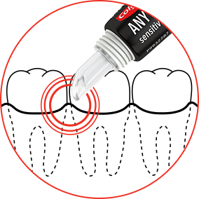 Aligner Relief - Colgate Anywhere, Anytime Sensitivity Relief Serum