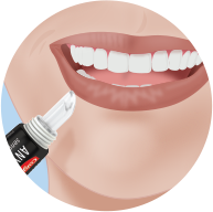 Load image into Gallery viewer, Aligner Relief - Colgate Anywhere, Anytime Sensitivity Relief Serum
