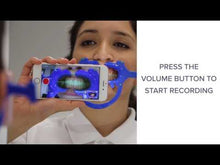 Load and play video in Gallery viewer, Dr. Aligner Monitoring Retractors - for use with or without Scan Box
